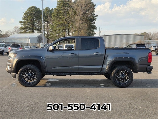 2017 Chevrolet Colorado Z71